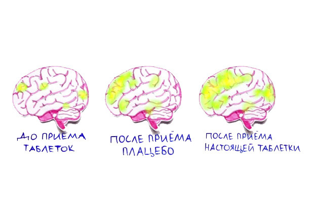 Схематичное сравнение работы плацебо и действующих препаратов