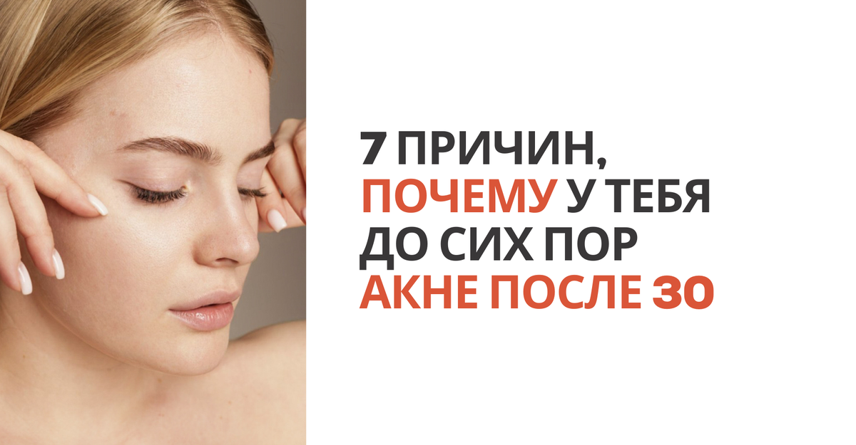7 причин, почему у тебя до сих пор акне после 30