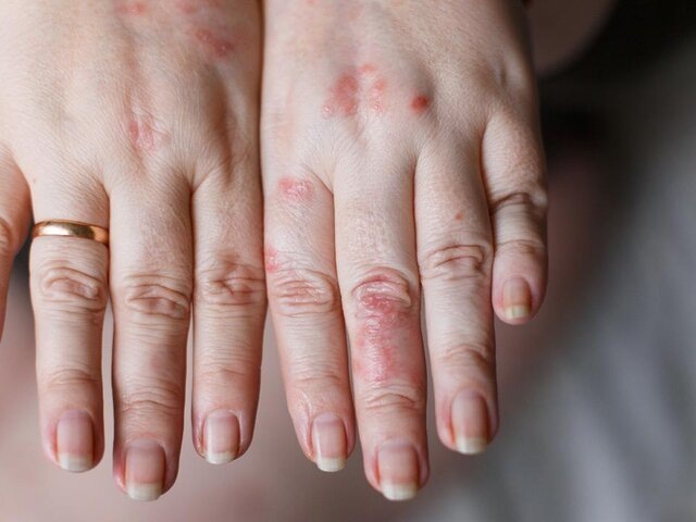    Фото: depositphotos/ternavskaia.o@gmail.com