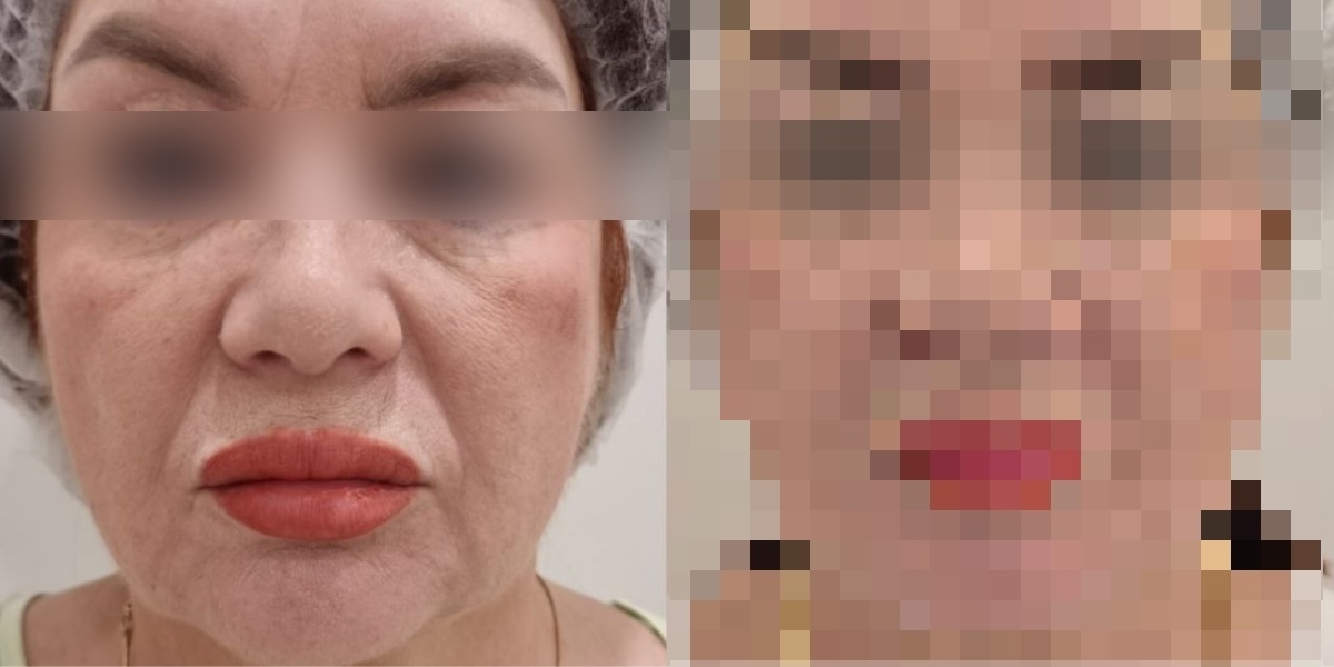 ИМЕЮТСЯ ПРОТИВОПОКАЗАНИЯ, НЕОБХОДИМА КОНСУЛЬТАЦИЯ СПЕЦИАЛИСТА