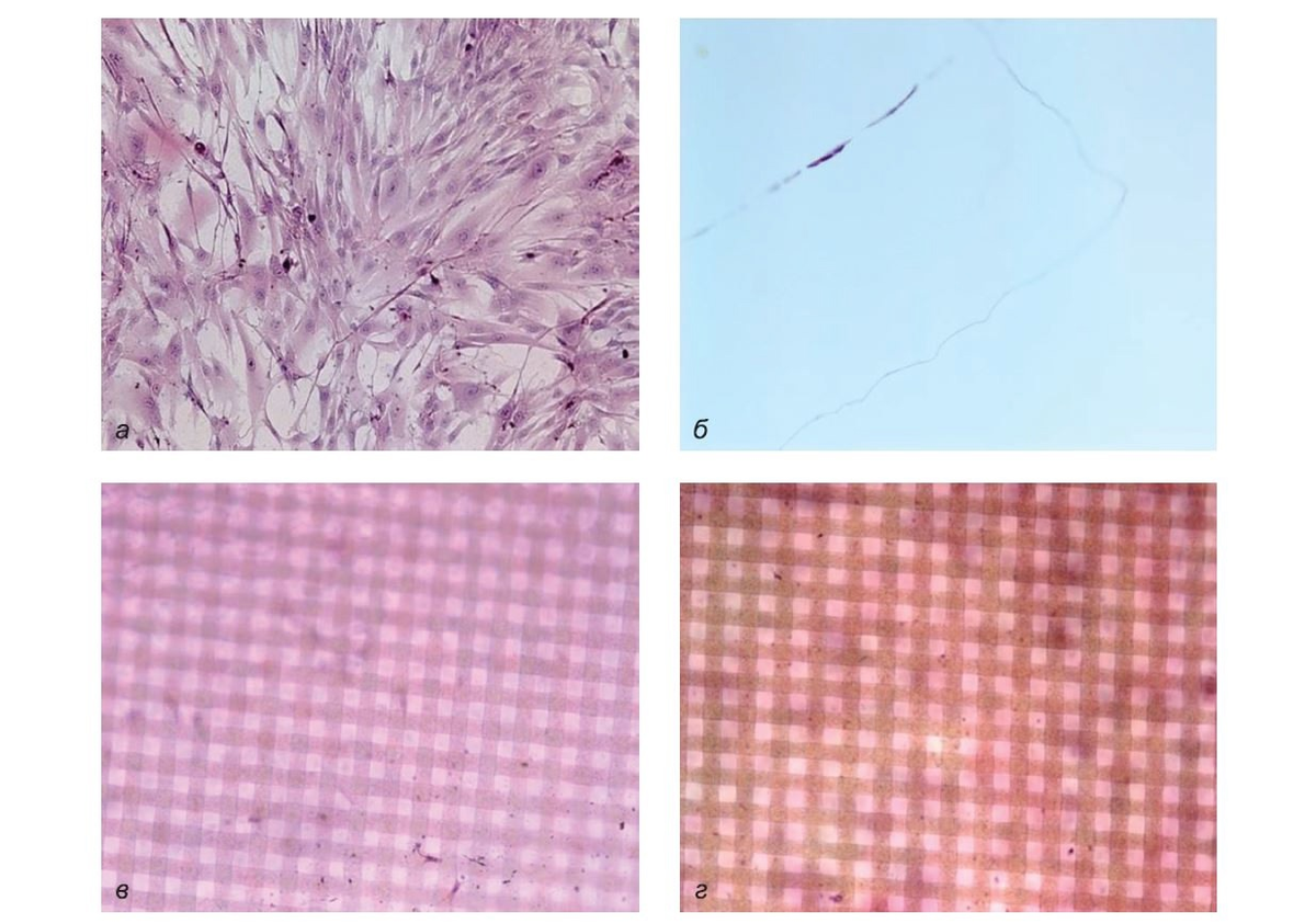 Рис. 1. Заселение фибробластов на заплату R4. Окрашивание гематоксилином и эозином,
×200 (а),×100 (б, в, г).
а — культура фибробластов человека. б — отсутствие фибробластов на боковой поверхности заплаты.
в, г — отсутствие фибробластов на обеих поверхностях заплаты.