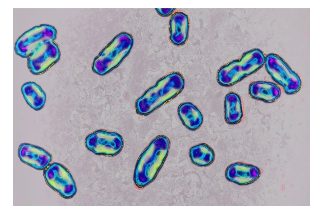 На снимке под микроскопом изображена бактерия Yersinia pestis, вызывающая чуму. BSIP/Universal Images Group/Getty Images