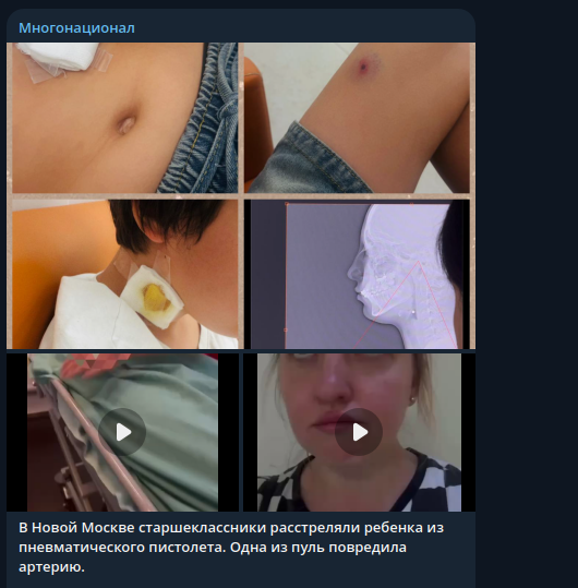  Фото: скриншот Telegram/"Многонационал"