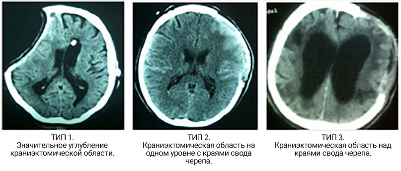 Рисунок 1. Архавлис и др. (34).
