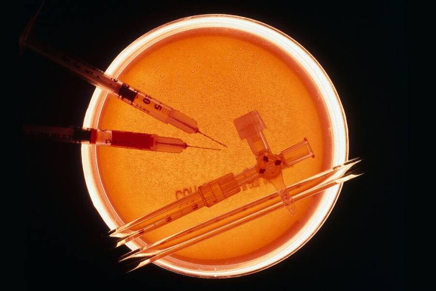 Фото: Wellcomeimages.com