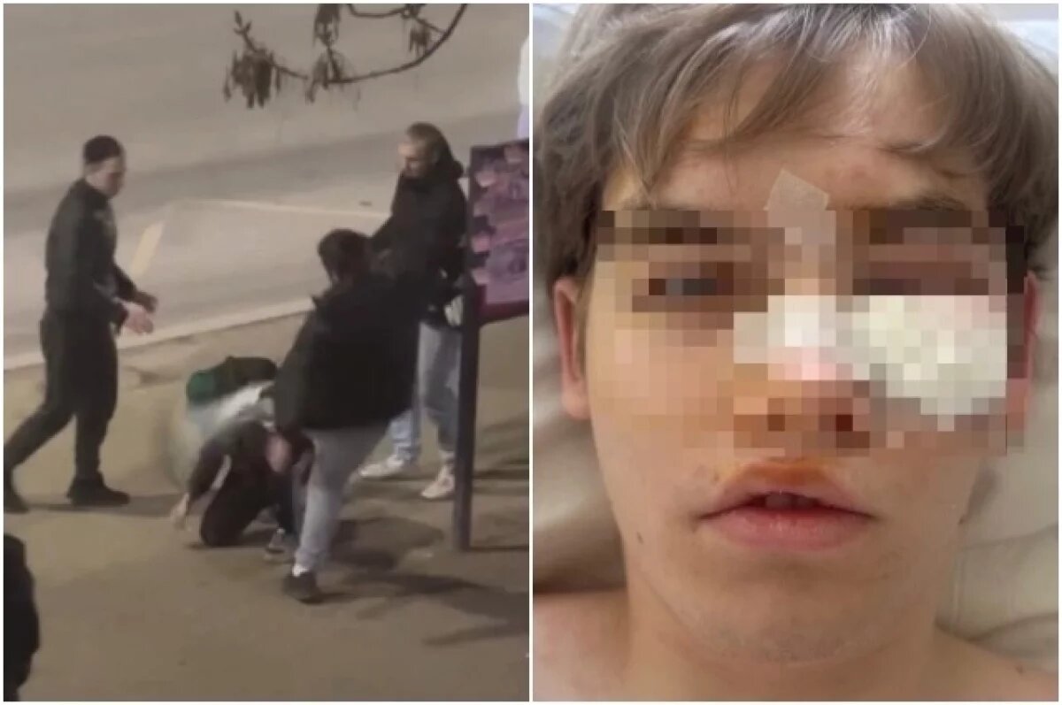    Одной из жертв серии нападений 3 мая 2024 года стал 19-летний студент