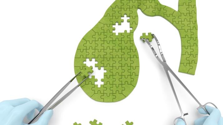     Основной компонент желчи — это желчные кислоты. Фото: Getty images