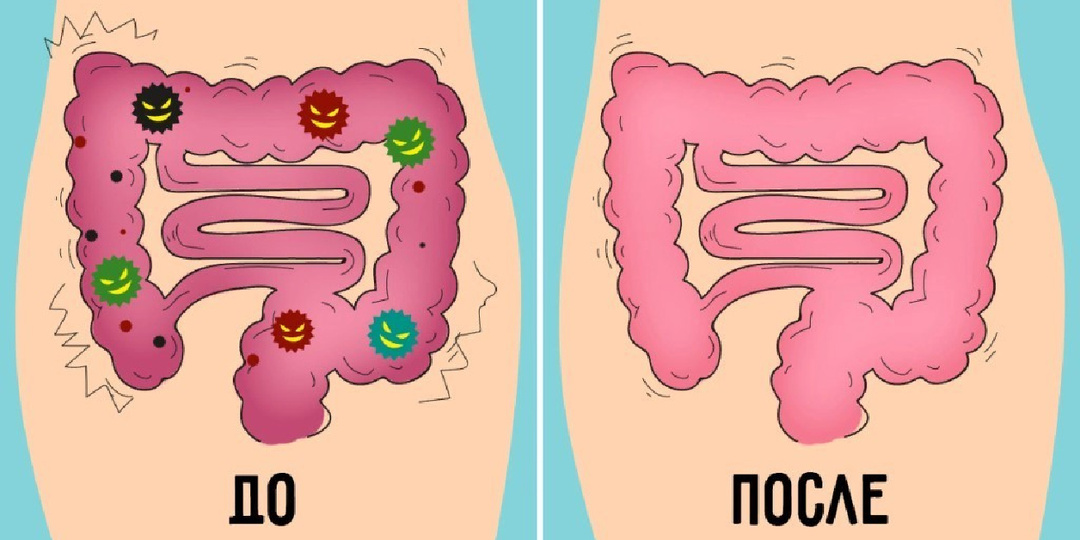 Как понять, что кишечник работает с перебоями — 5 признаков
