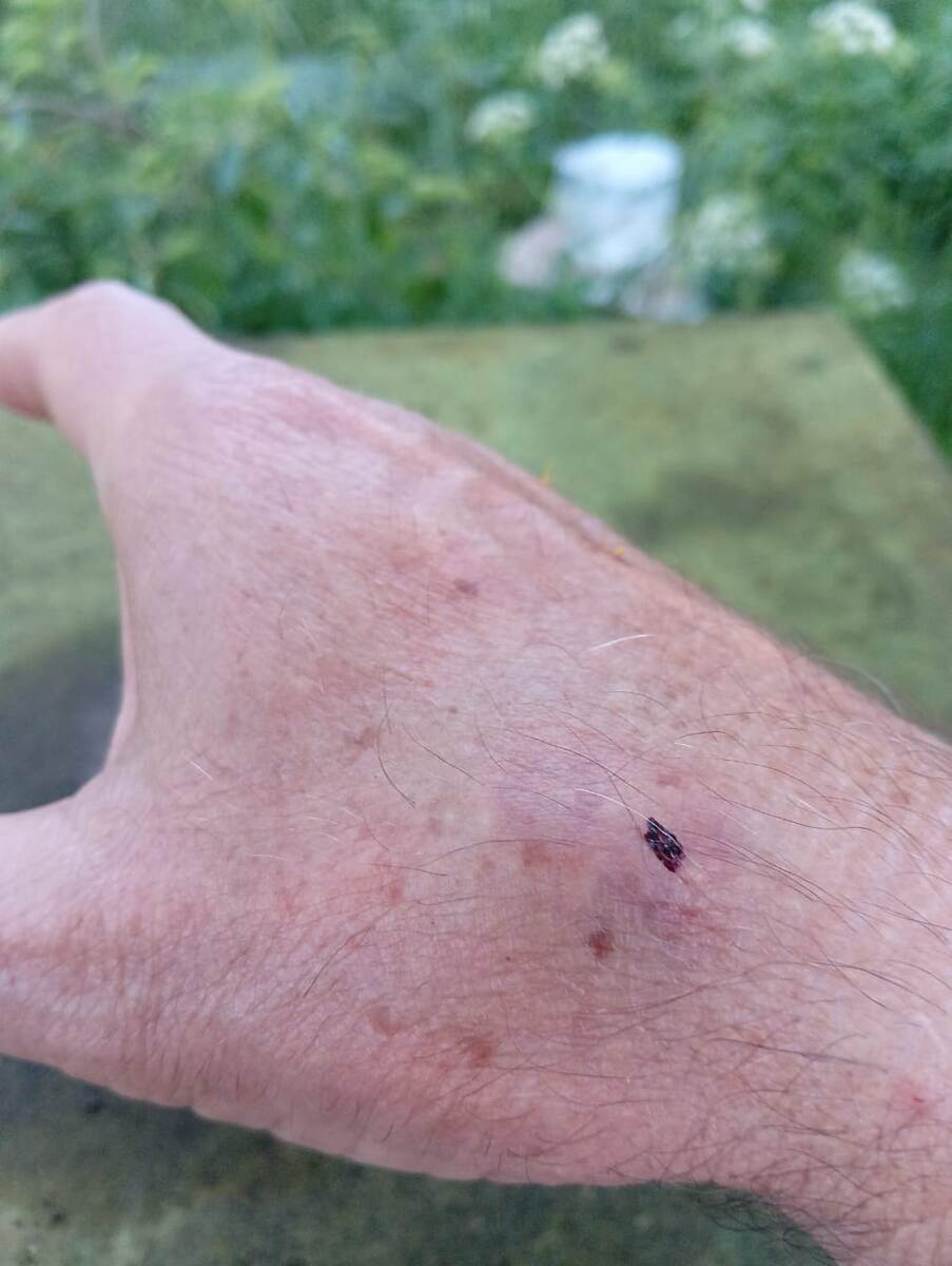 место укола.