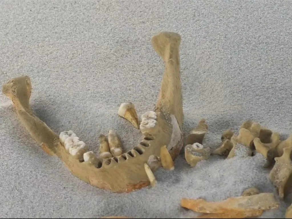 Изображение нижней челюсти и зубов. 