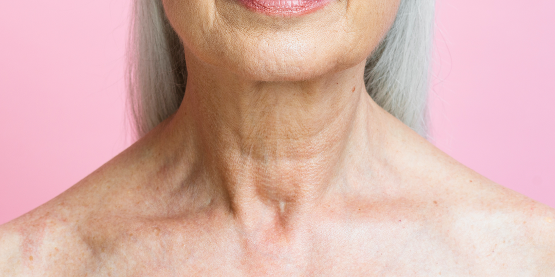 Убираем кольца Венеры на шее: самые действенные способы