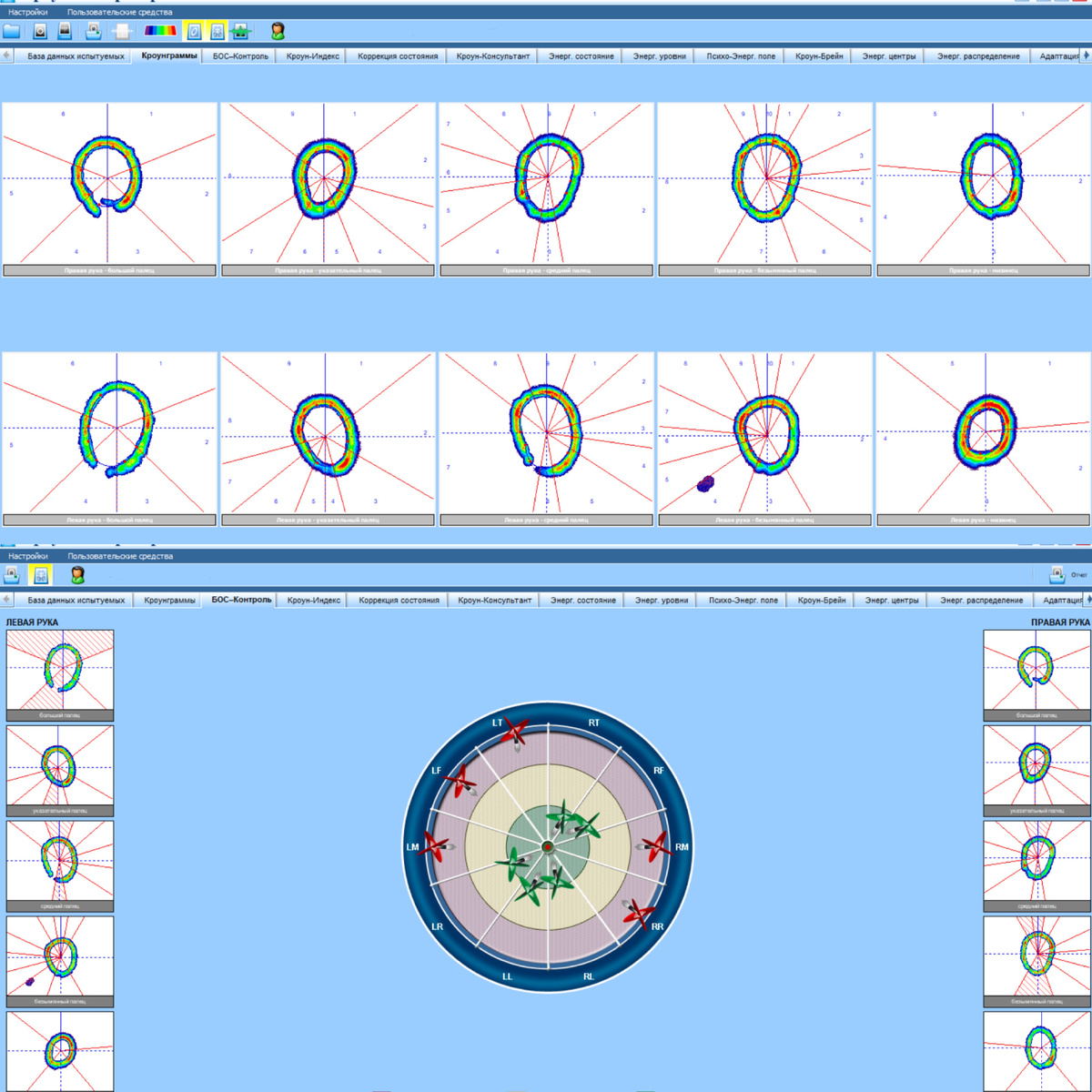 Кроунограммы и зоны риска на диаграмме (фото автора)