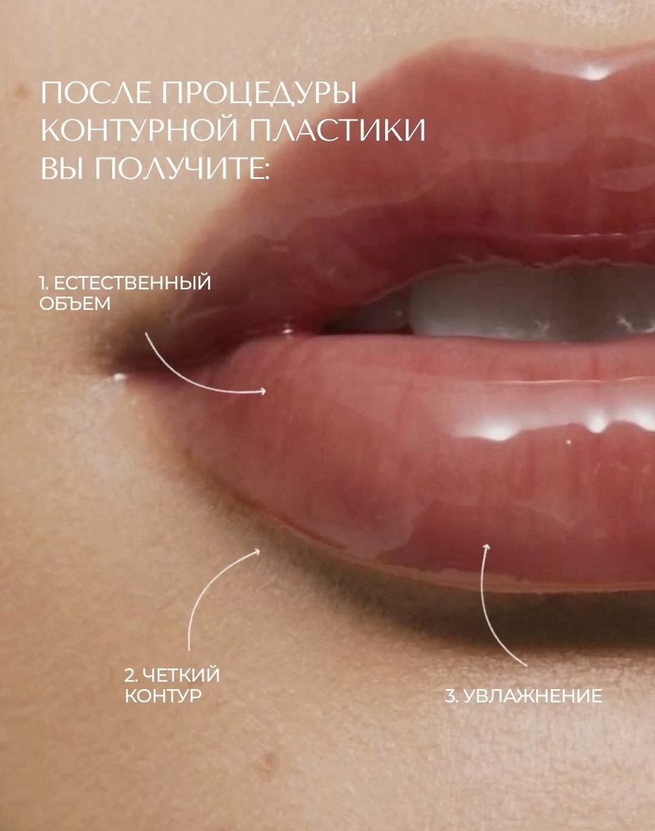 Запишитесь на процедуру в салон Via Beaute! 💋🌟