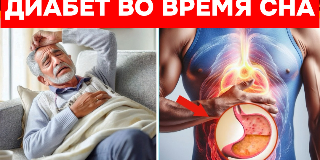 Как сделать так, чтобы диабет не крал твой сон: простые шаги к спокойной ночи