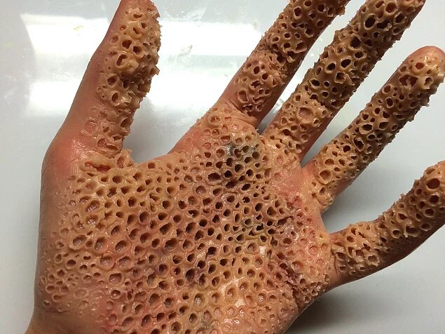 Трипофобия - это иррациональный страх или отвращение, которое человек испытывает при виде расположенных близко друг к другу отверстий или углублений. 
