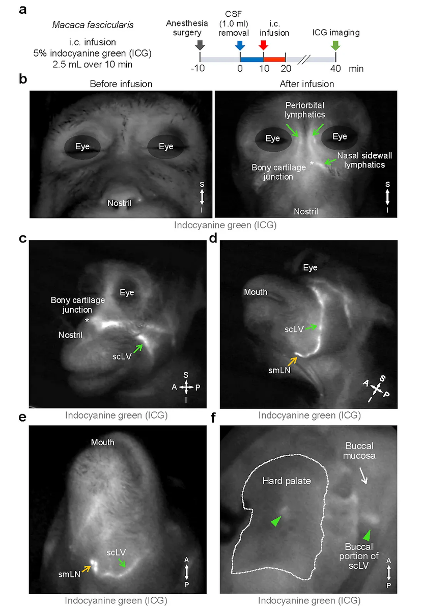 Спинномозговая жидкость, помеченная флуоресцентным маркером, проходит через лимфатические сосуды вокруг глаз, носовой области, твердого неба и шеи обезьяны. Источник: Институт фундаментальных наук, используется с разрешения