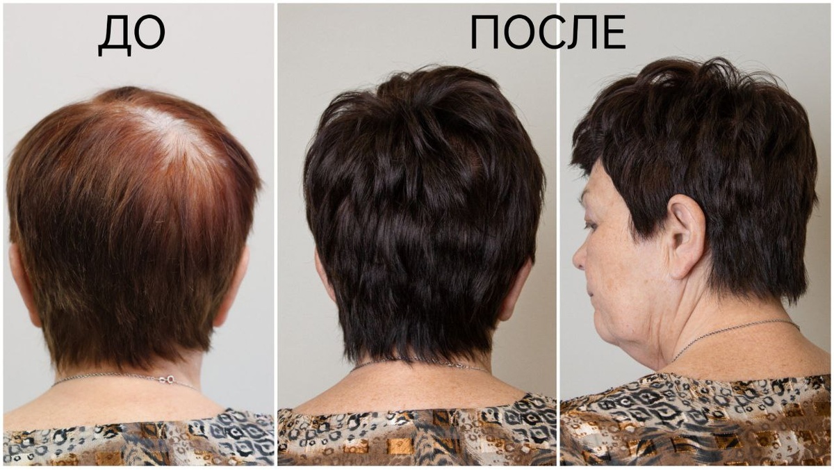 Окрашивание ASSORT ALLIA C 