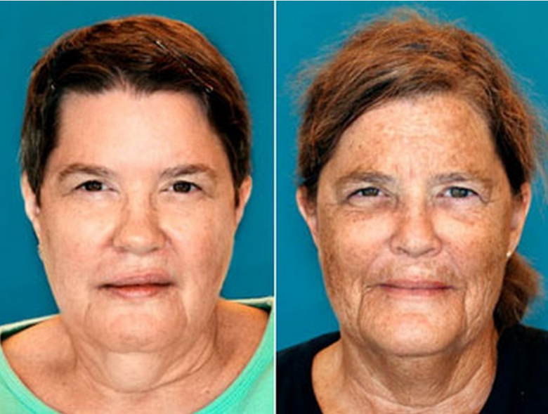 University Hospital Medical Group