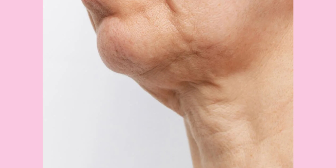 Шея выдает возраст: эффективные методы против старения кожи