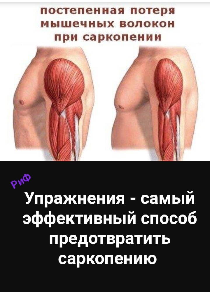 Упражнения - самый эффективный способ предотвратить саркопению.