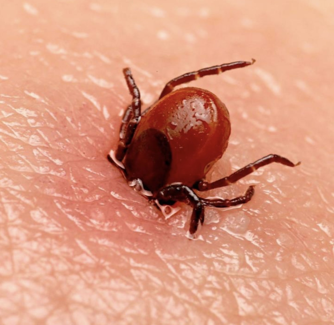 Укус клеща