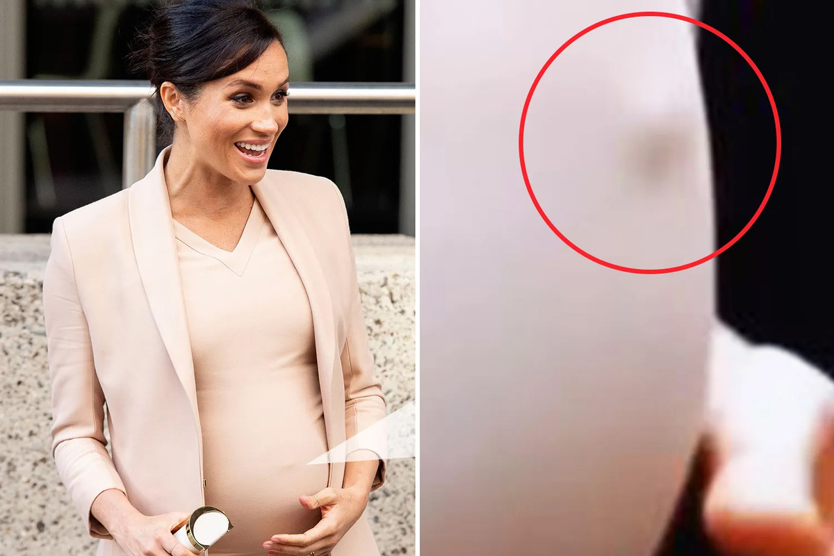 Меган Маркл. Как Меган Маркл инсценировала «беременность века» — расследование скандала с Лилибет.