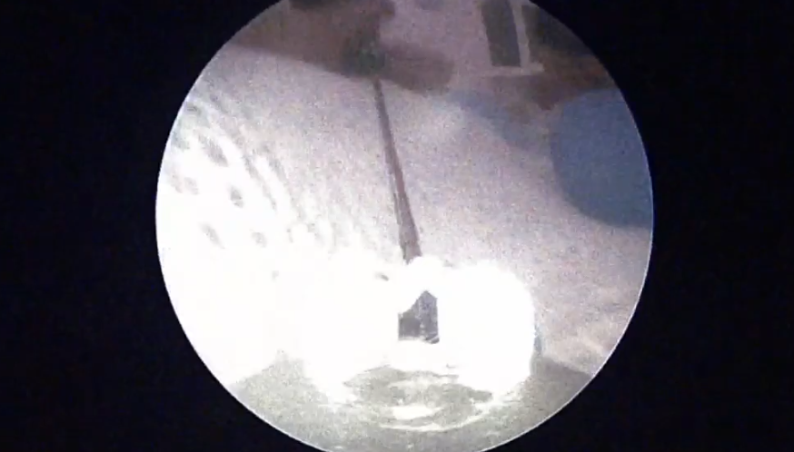    Источник фото: Скрин видео