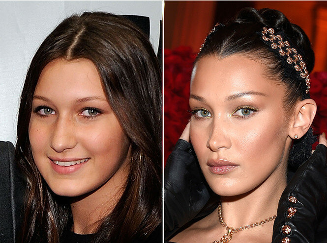 Белла Хадид до и после пластики