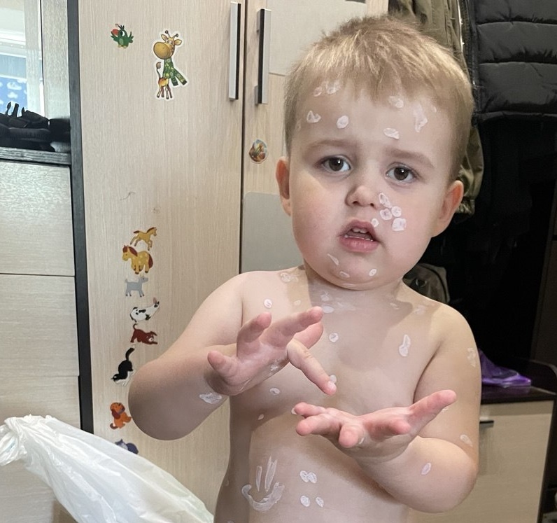 и это только начало болезни