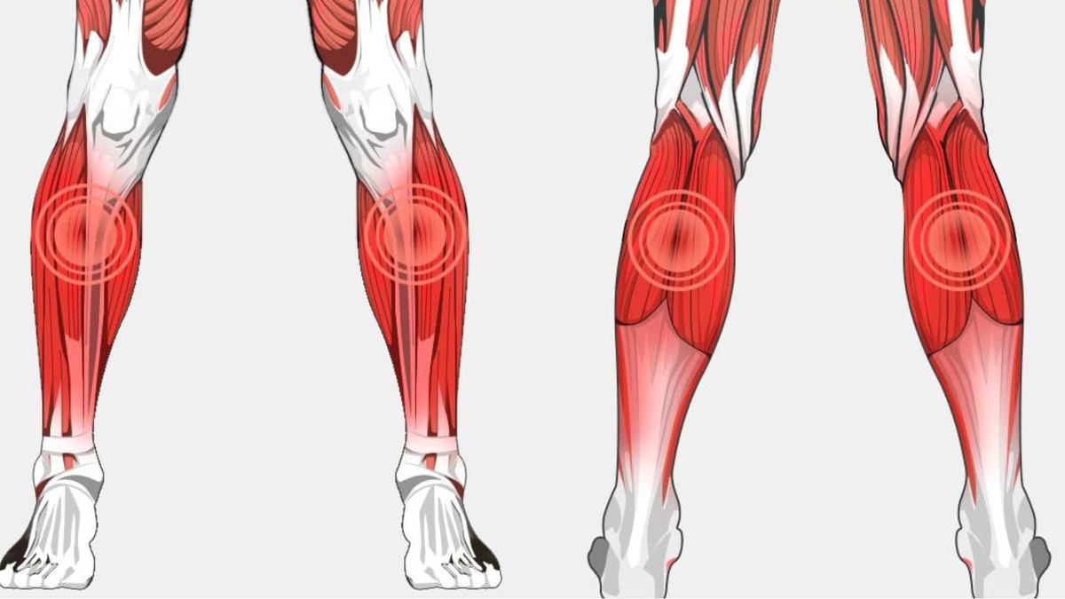 Почему тянет икры по ночам: 5 скрытых проблем