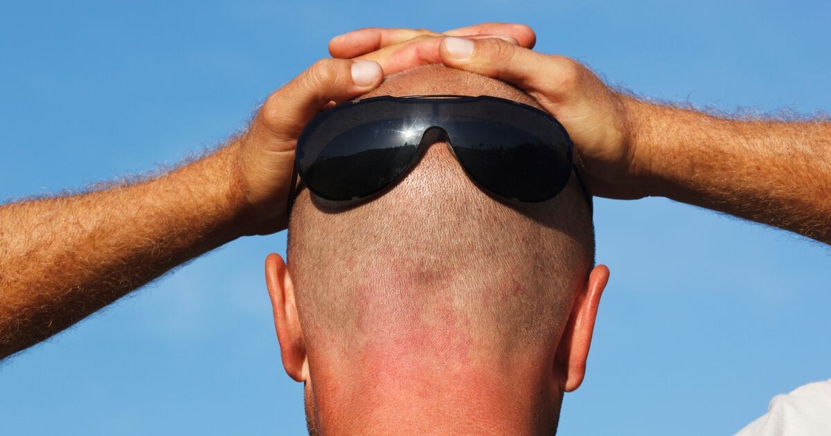 Как распознать «долбоёба