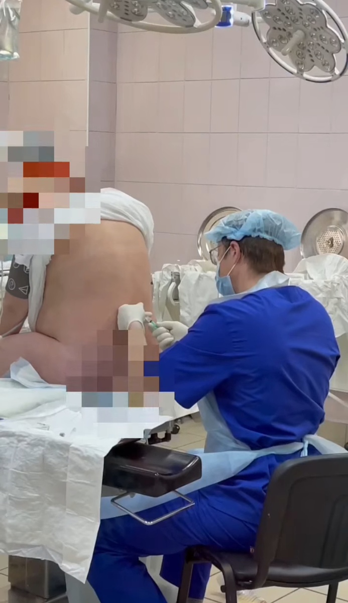 Выполнение эпидуральной анастезии