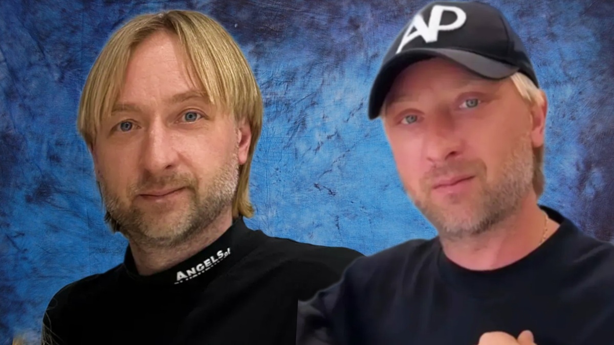 Евгений Плющенко "до и после" пластики