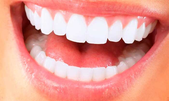 Отбеливание зубов