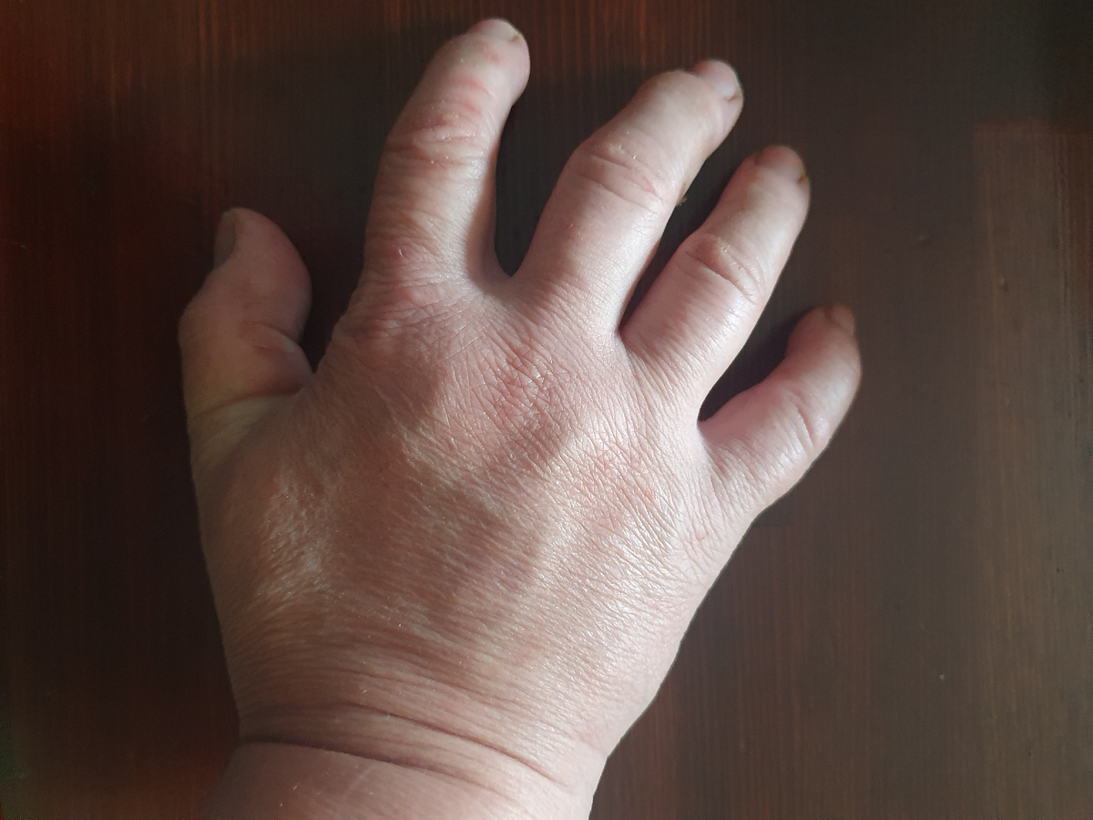 Прямо как Вещь из семейки Аддамс. Правда у нее (него) пальцы ровнее.