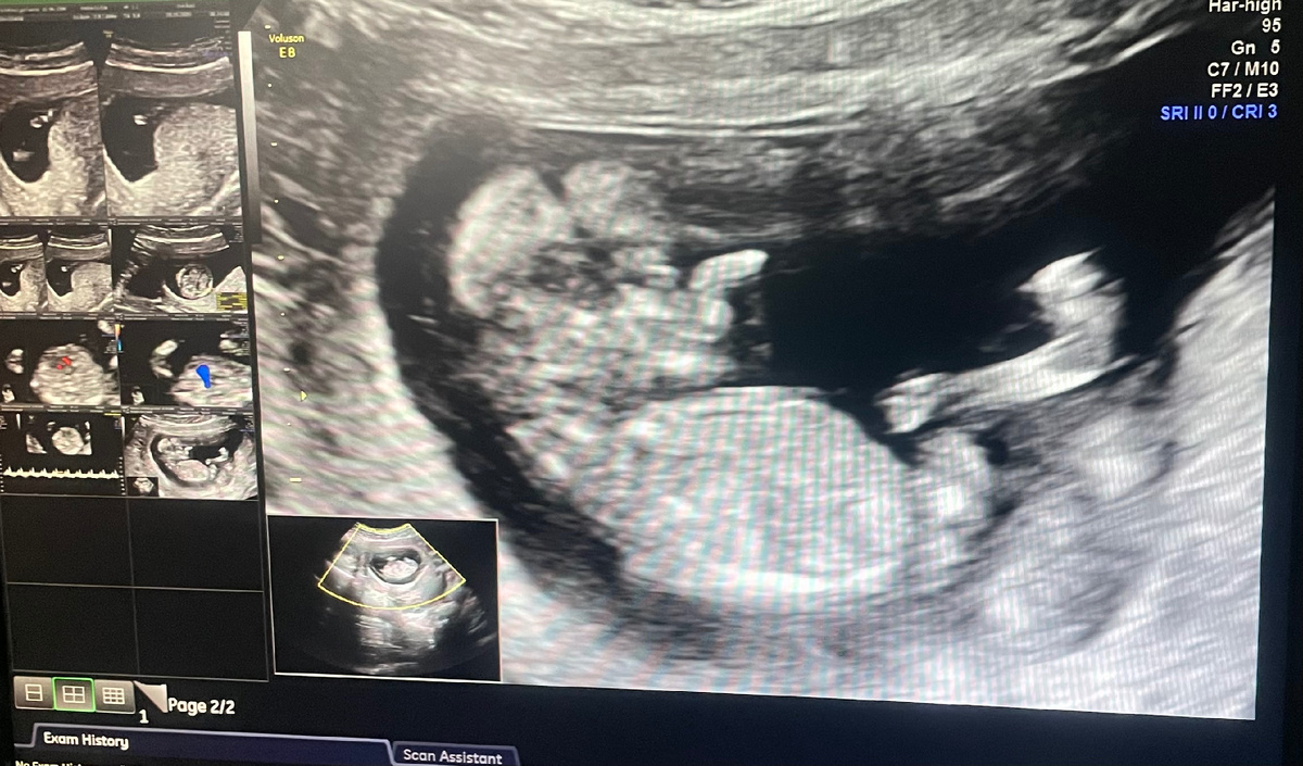 Врач никак не могла поймать изображение, чтобы ручки убрал от лица 🙂 