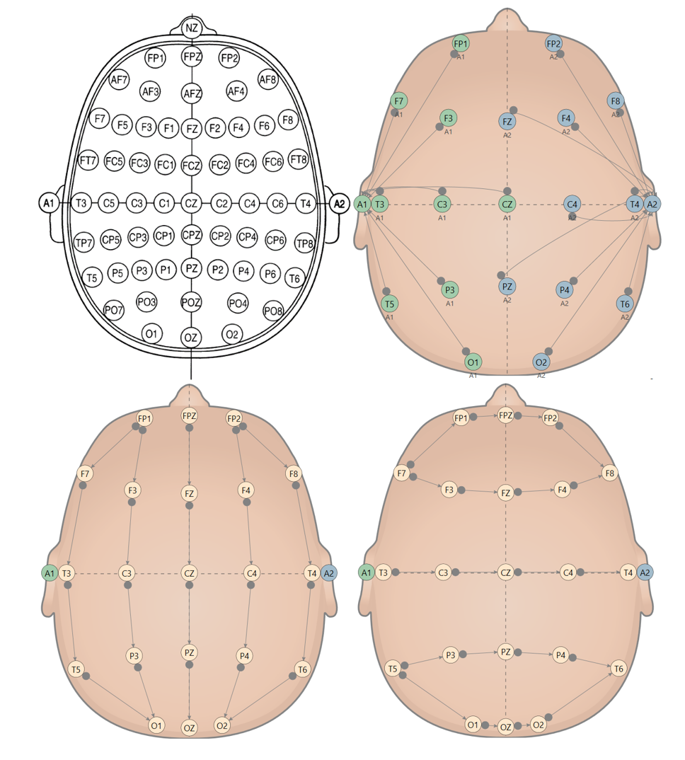 Монтажи для регистрации ЭЭГ (международная система "10-20%").