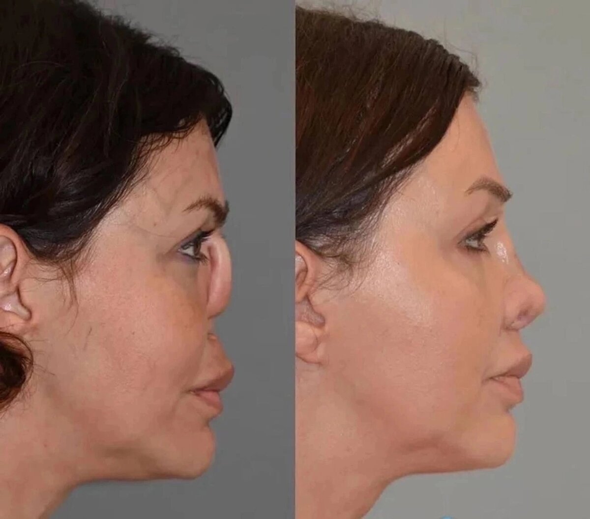 Алиса Казьмина. Фото из открытого источника