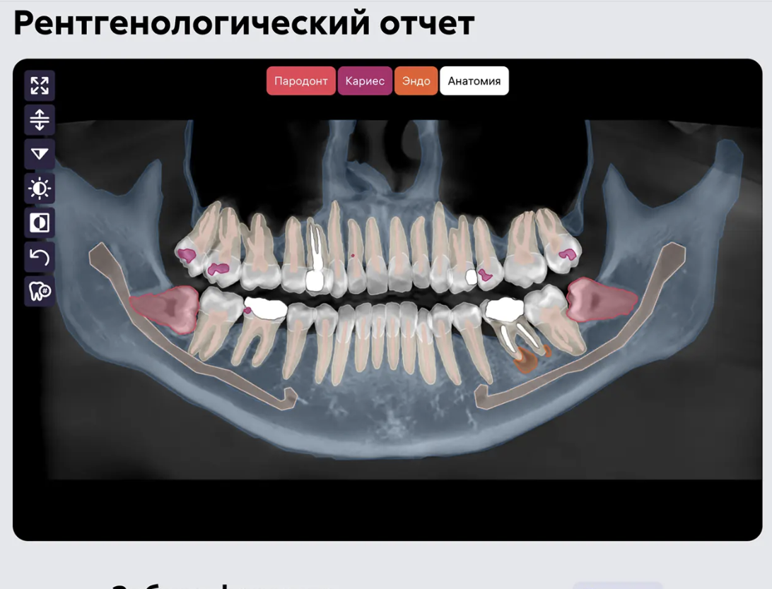 С официального сайта https://diagnocat.ru/