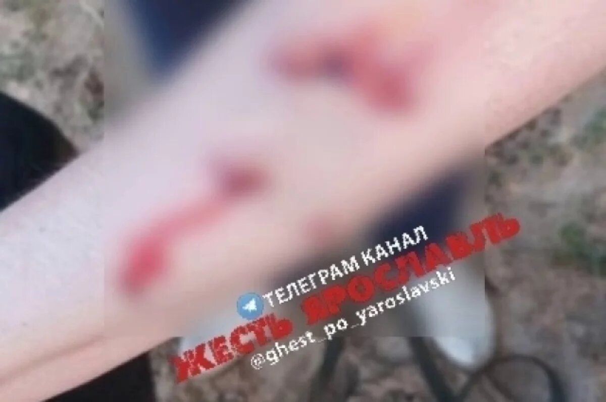    В Ярославле собака покусала женщину