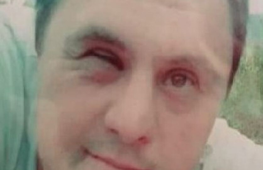 Брянец с косоглаглазием и палочкой для ходьбы пропал три дня назад