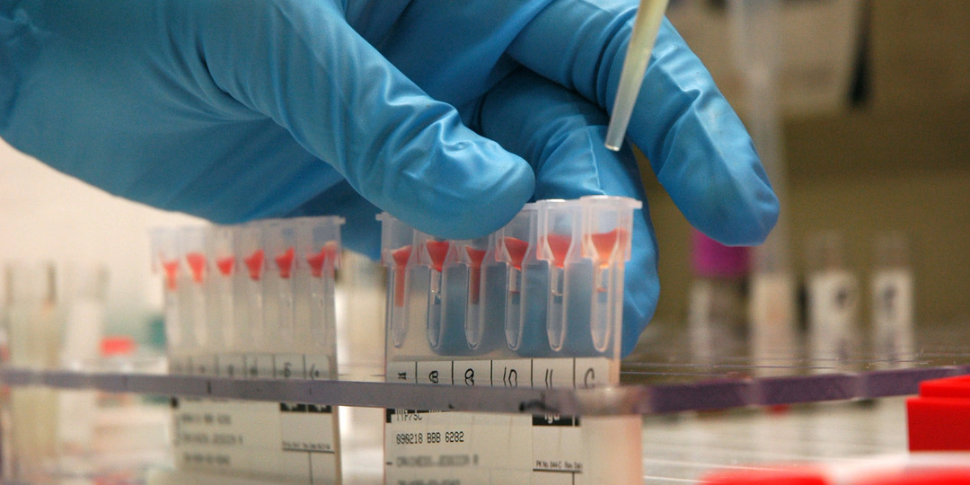 Диетолог Д'Ада советует людям со II группой крови не есть курицу