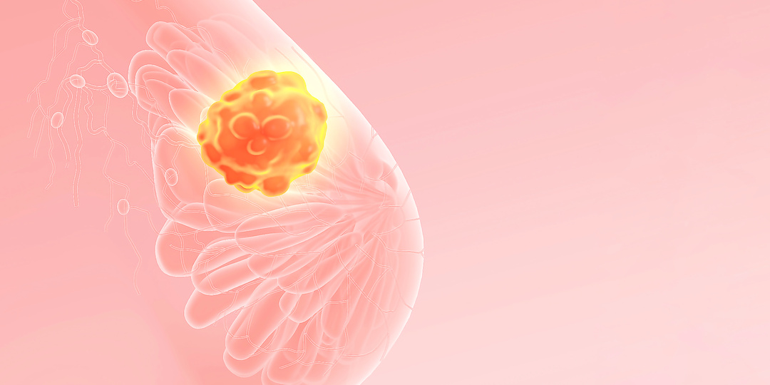 МОЙ ПУТЬ БОРЬБЫ С РАКОМ