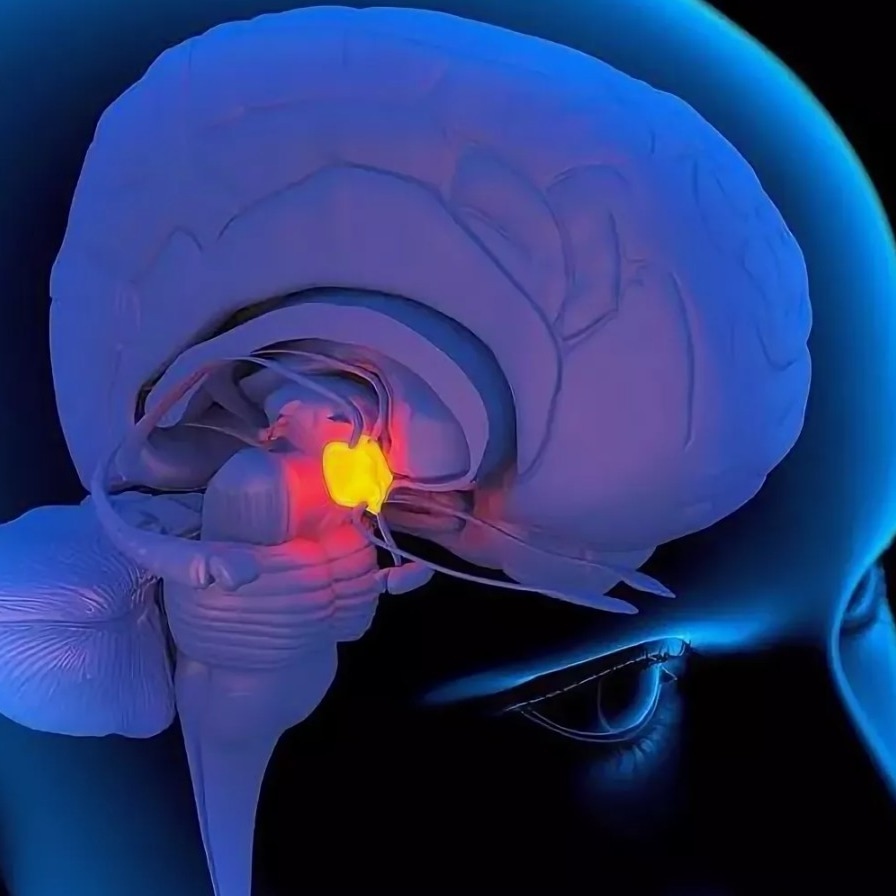 Мозг человека - лакомство для акулы 