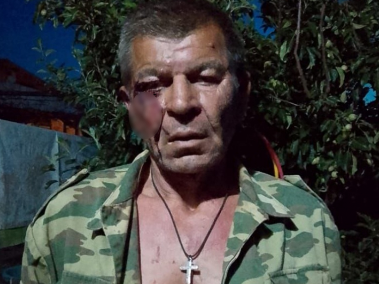 Пострадавший пенсионер. Фото: Блокнот.ру.