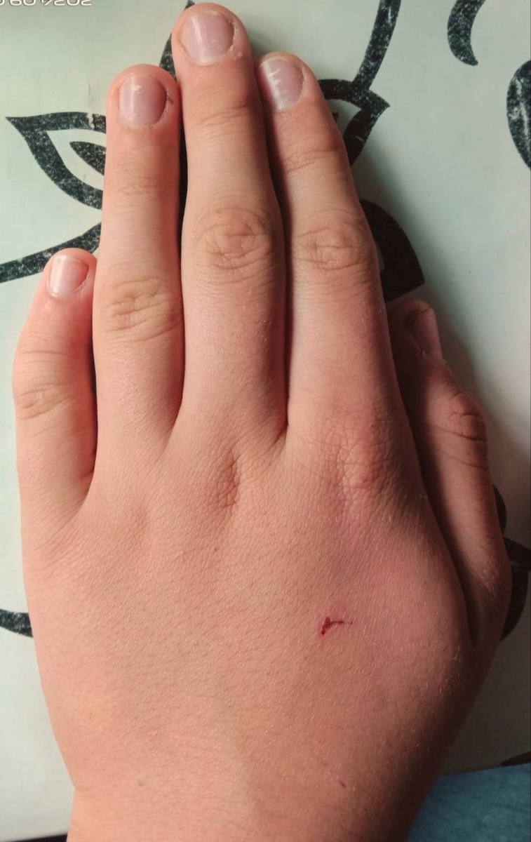 Мальчик, 13 лет. Дислексия