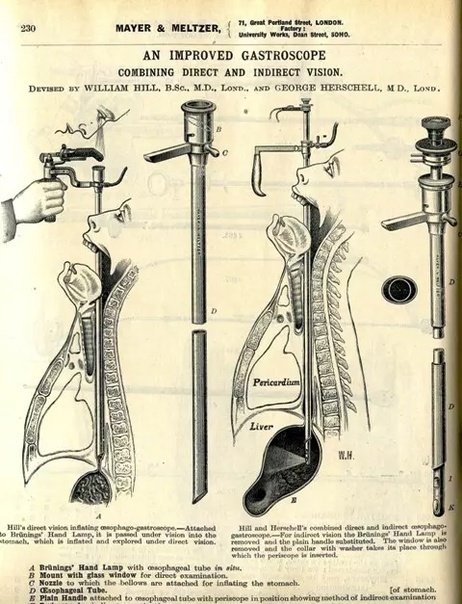 Жесткий гастроскоп