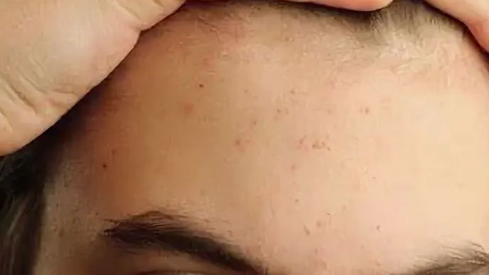 Лоб выдает пищеварение