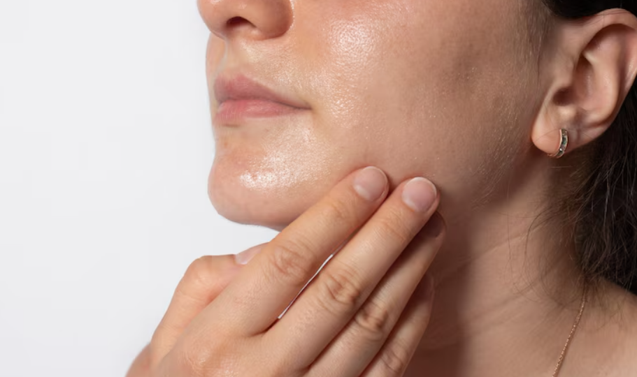 Жирная кожа: какие процедуры подходят, а от каких стоит отказаться