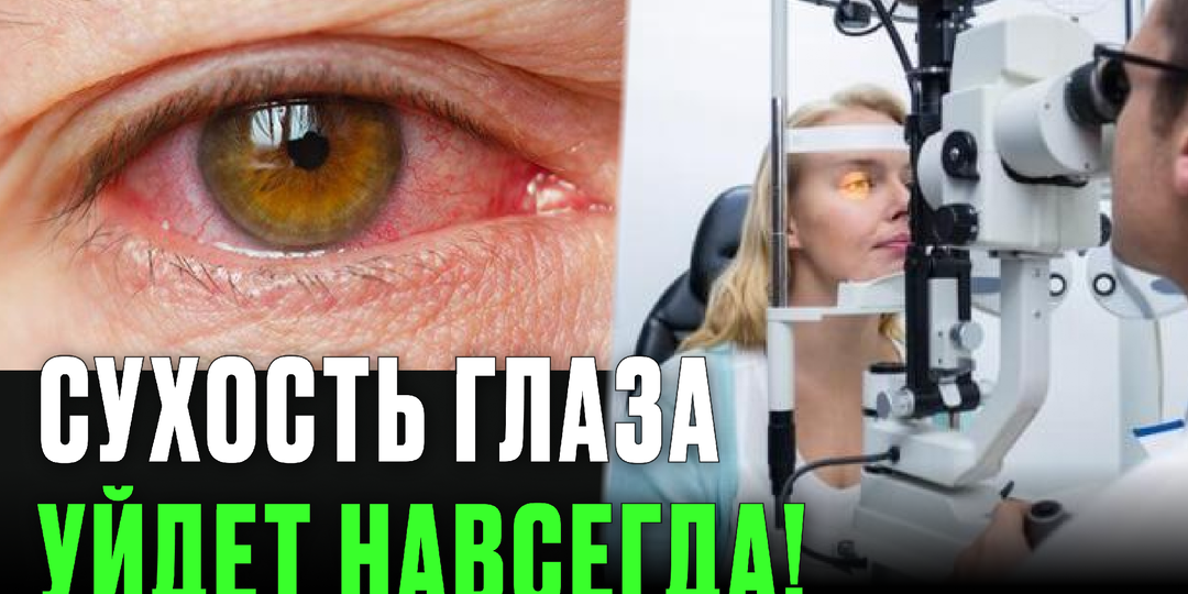 Сухой глаз мучает каждый день? Вот как избавиться за 5 минут — советы от офтальмолога, которые работают!